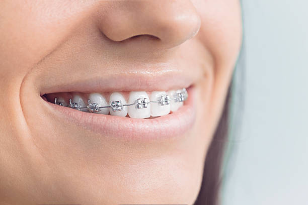 Best Dental Inlays and Onlays  in Vinings, GA